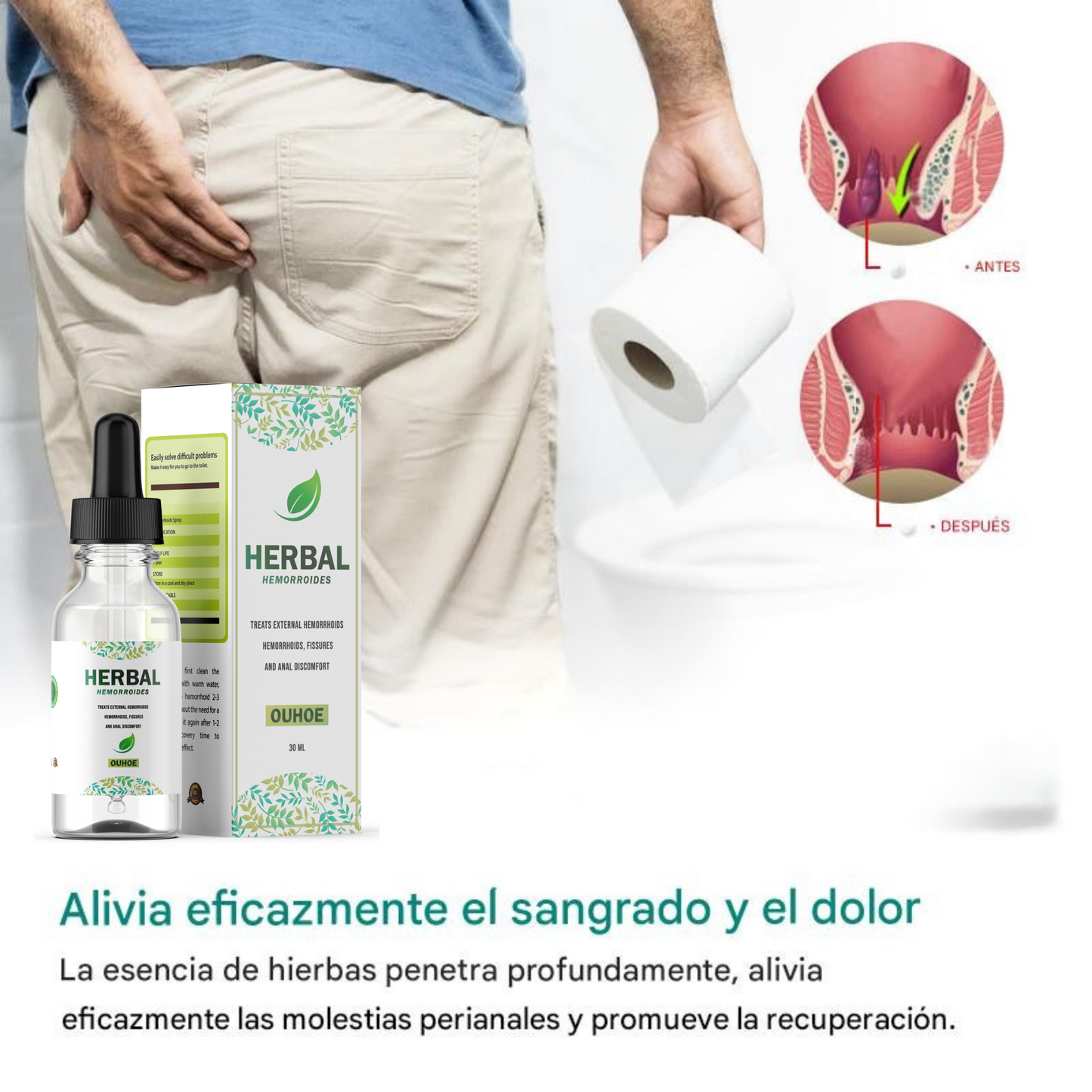 HERBAL PARA HEMORROIDE